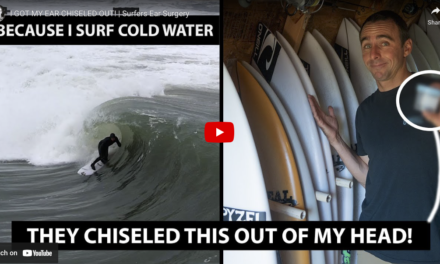 Video : Brett Barley Gets An Earful